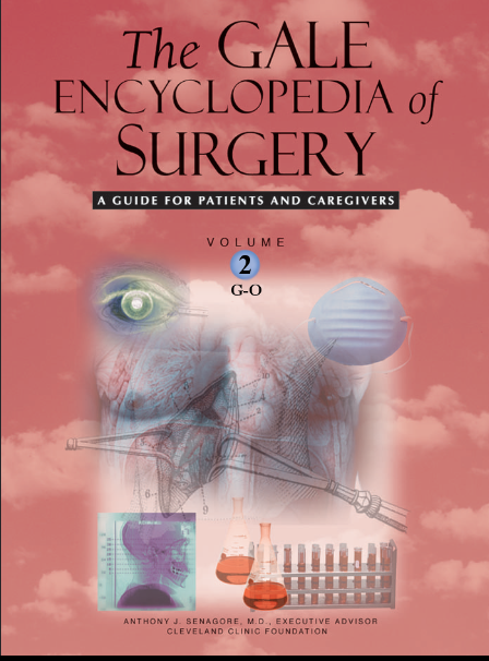 The Gale Encyclopedia of Surgery A Guide for Patients and Caregivers volume 2